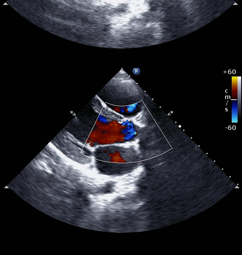 Stress Echocardiogram Top Cardiologist In Forest Hills Queens Ny 7721